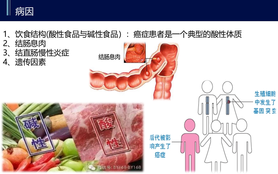 直肠癌PBL护理查房PPT课件15