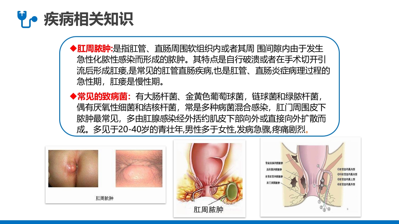 肛肠科护理查房PPT课件4