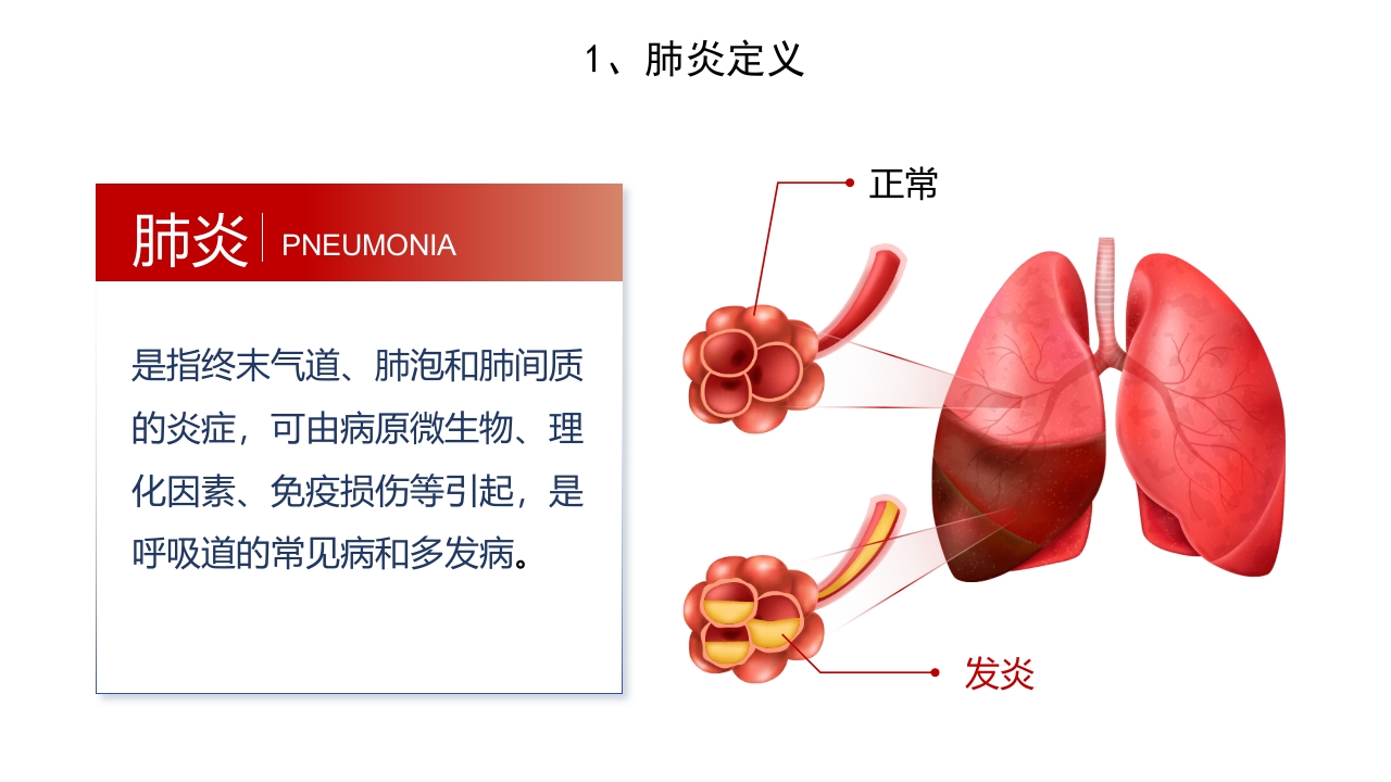 肺炎护理PPT课件5