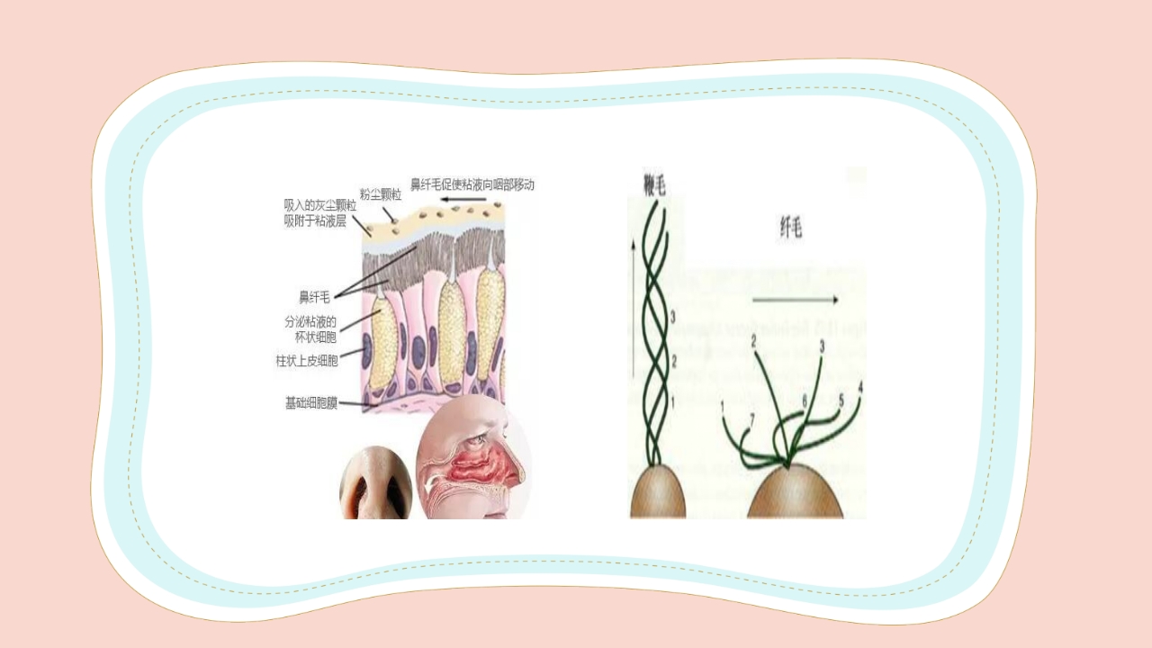 新生儿气道及呼吸机管路护理PPT课件36