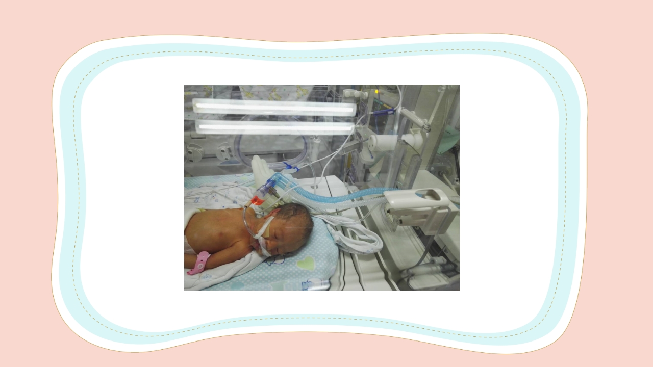 新生儿气道及呼吸机管路护理PPT课件38