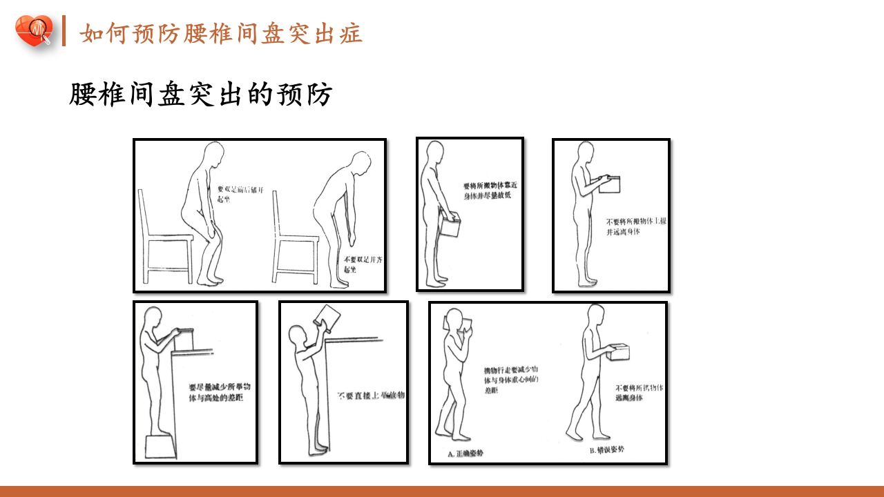 腰椎间盘突出症护理查房健康教育PPT课件29