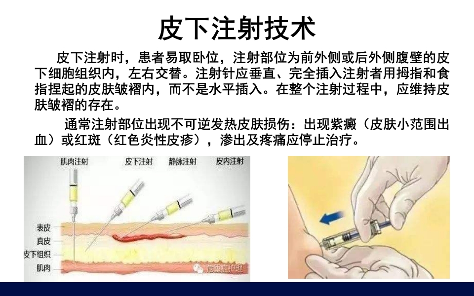 抗凝药物的合理使用PPT课件17