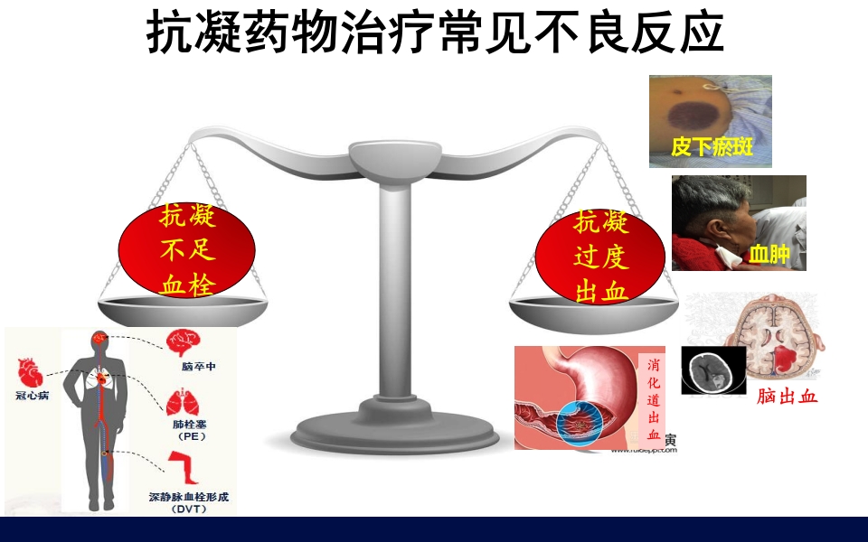 抗凝药物的合理使用PPT课件7