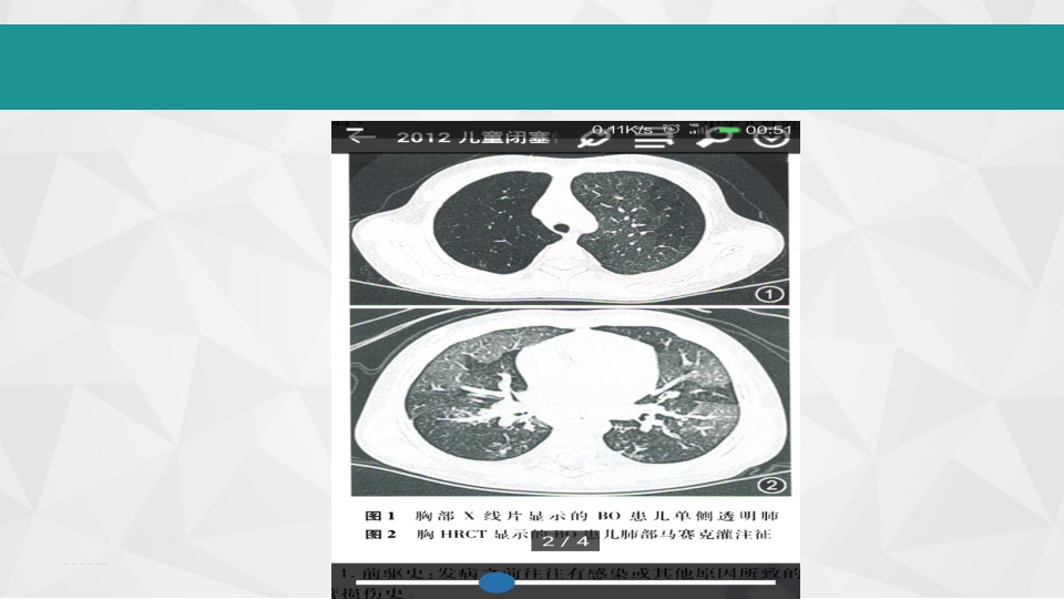 儿童闭塞性细支气管炎ppt课件16
