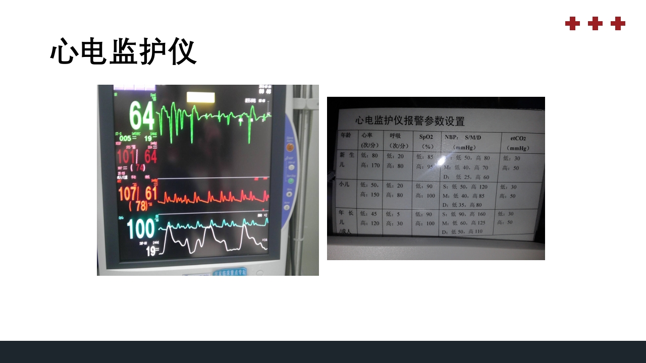 PICU儿童重症监护PPT课件16