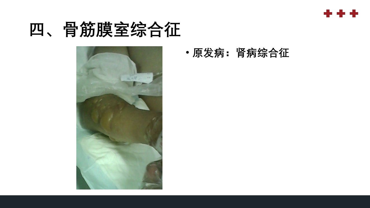 PICU儿童重症监护PPT课件37