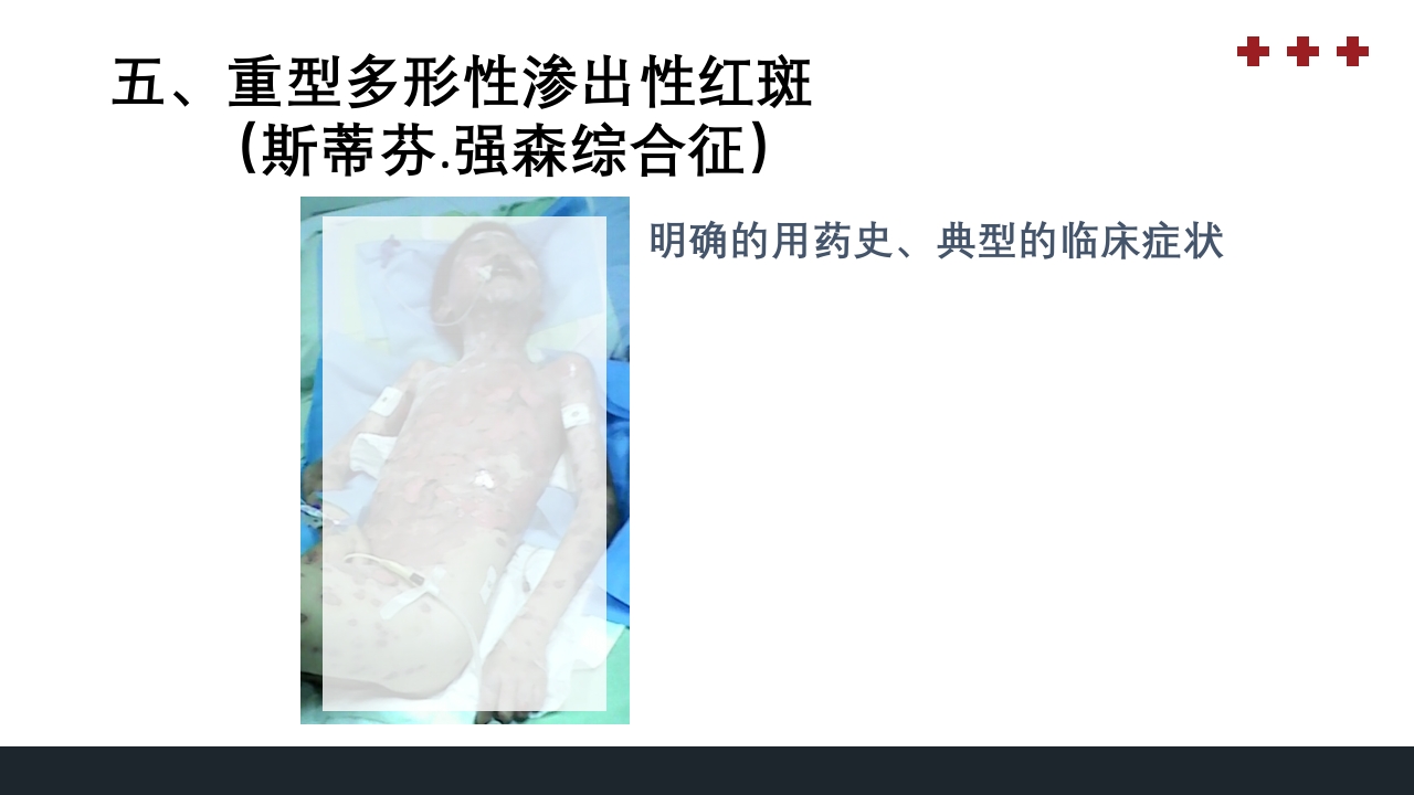 PICU儿童重症监护PPT课件38