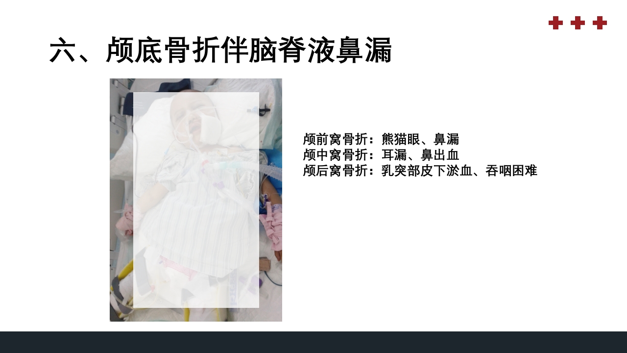 PICU儿童重症监护PPT课件39