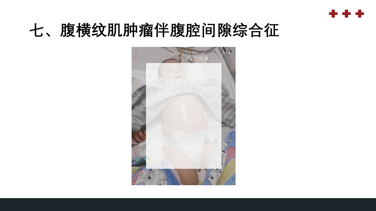 PICU儿童重症监护PPT课件40