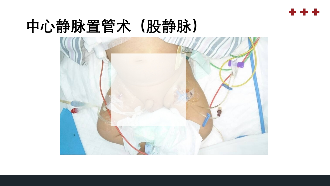 PICU儿童重症监护PPT课件6