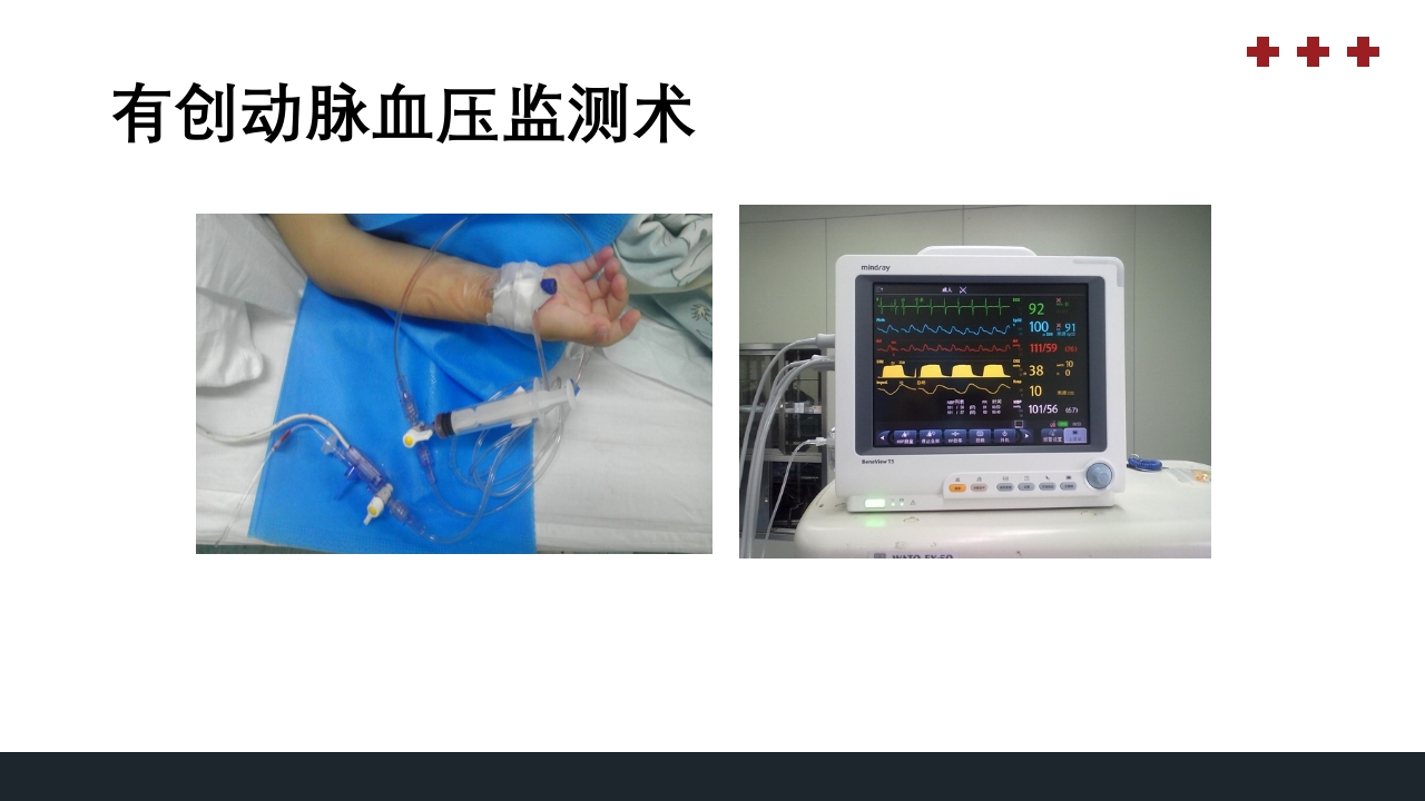PICU儿童重症监护PPT课件7