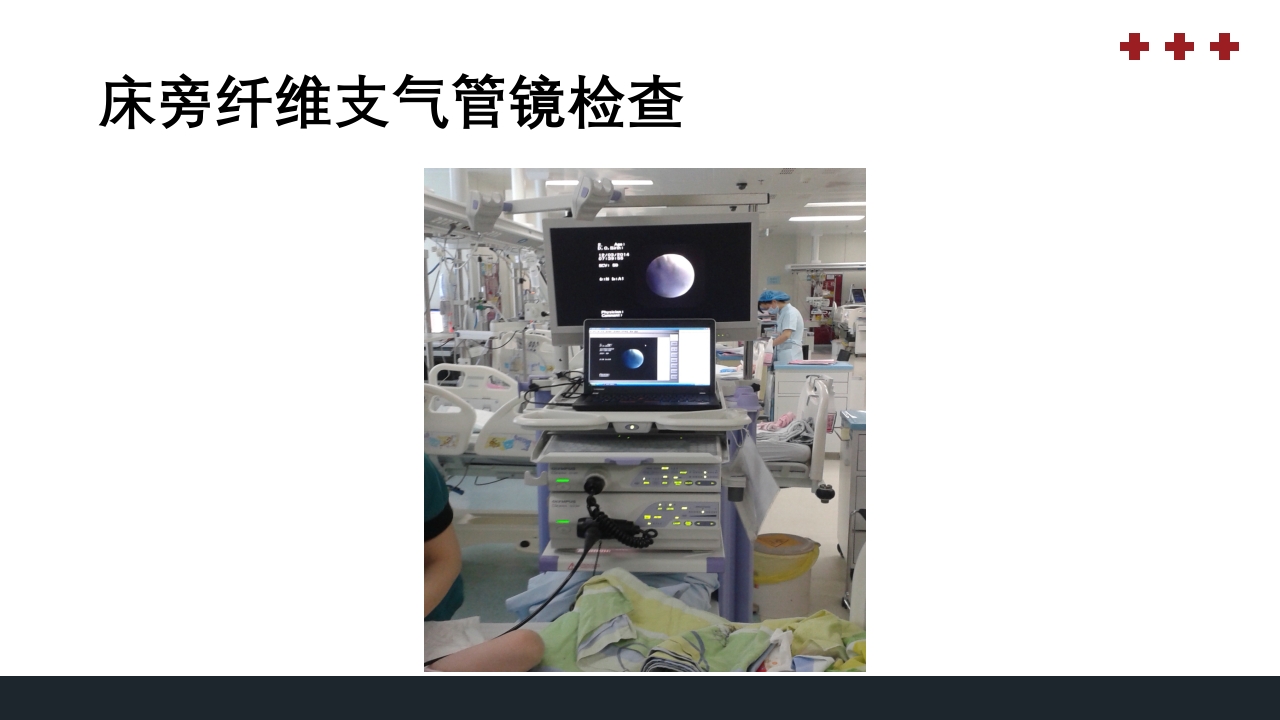 PICU儿童重症监护PPT课件9
