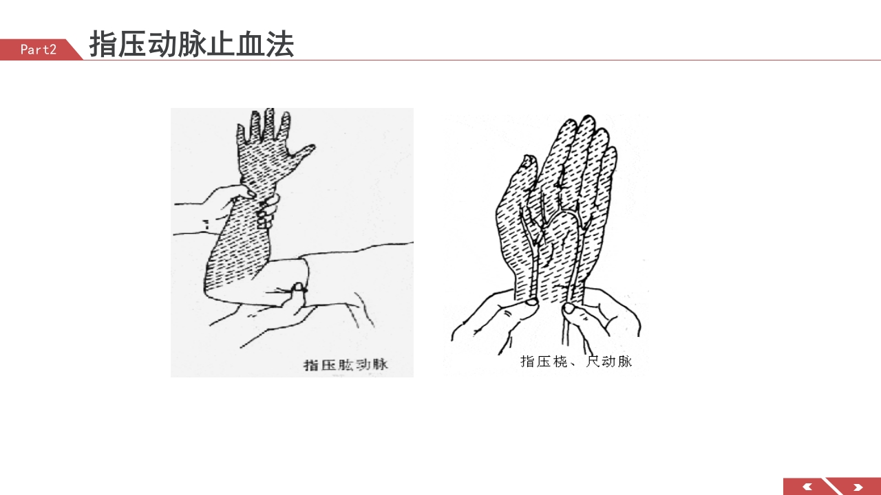 外伤急救包扎技术培训PPT课件11