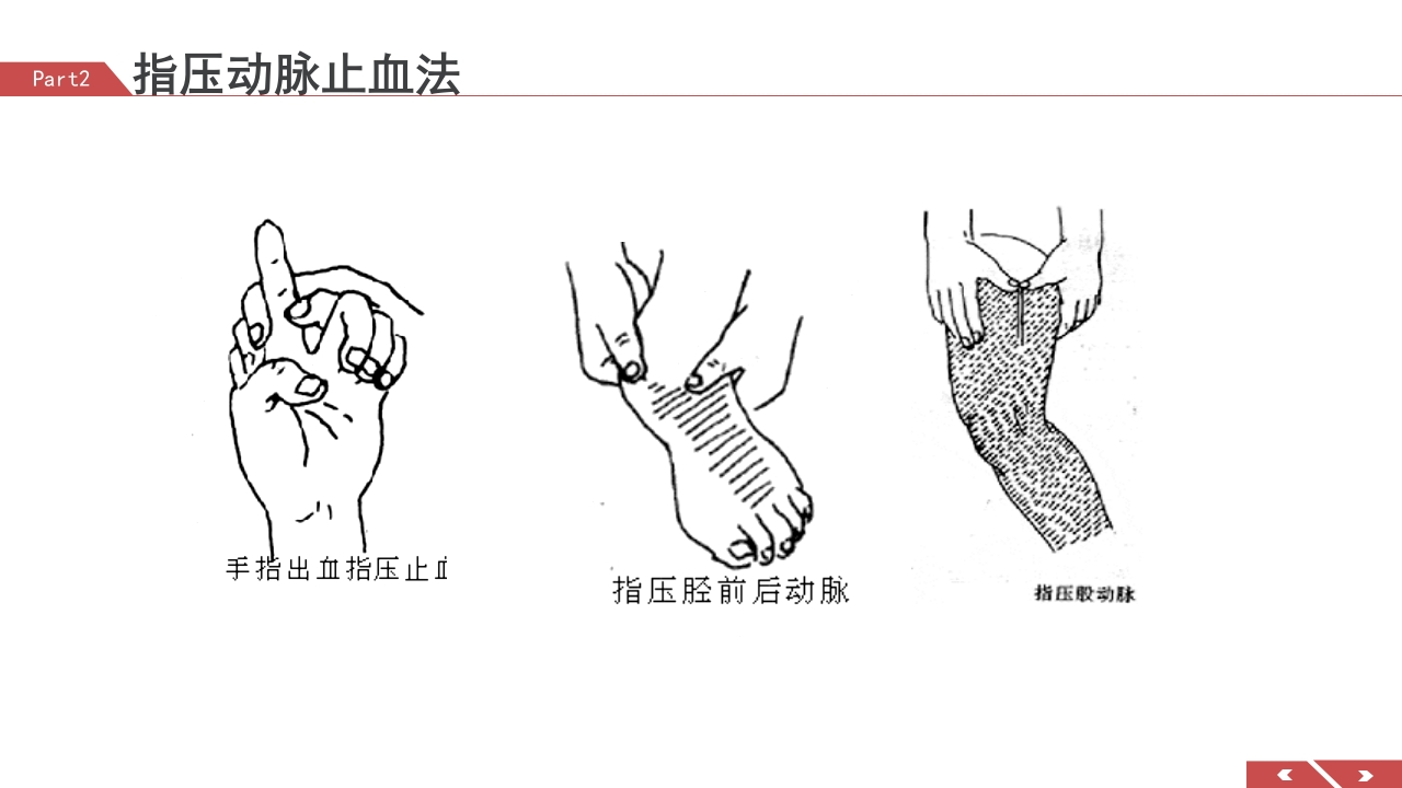 外伤急救包扎技术培训PPT课件12