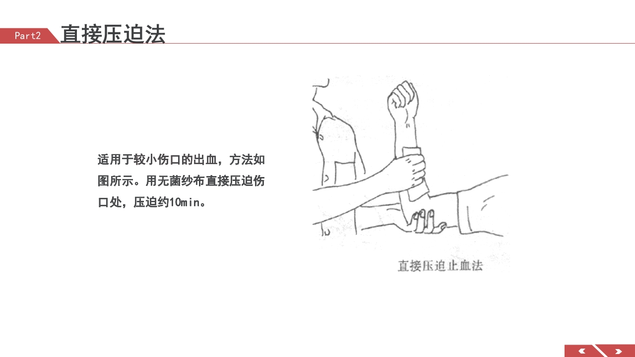 外伤急救包扎技术培训PPT课件13