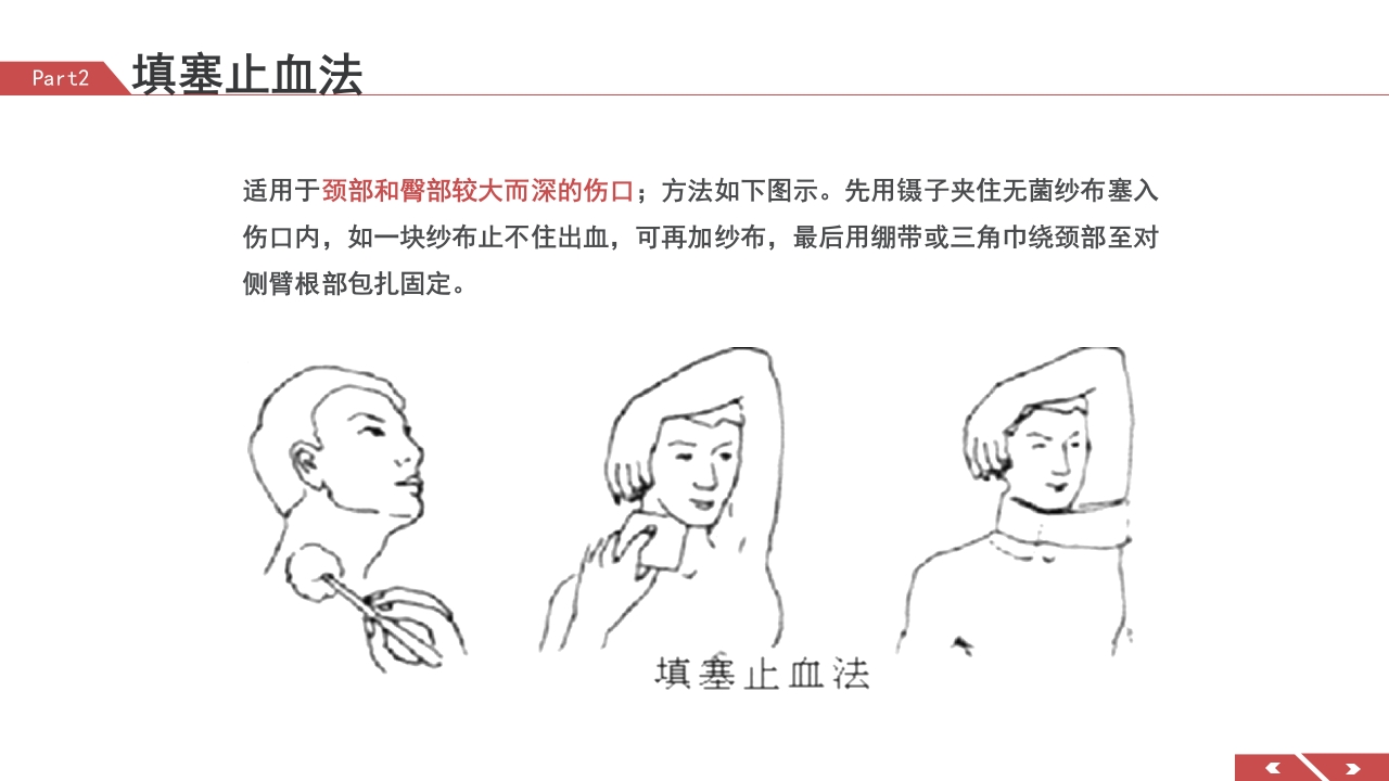 外伤急救包扎技术培训PPT课件15