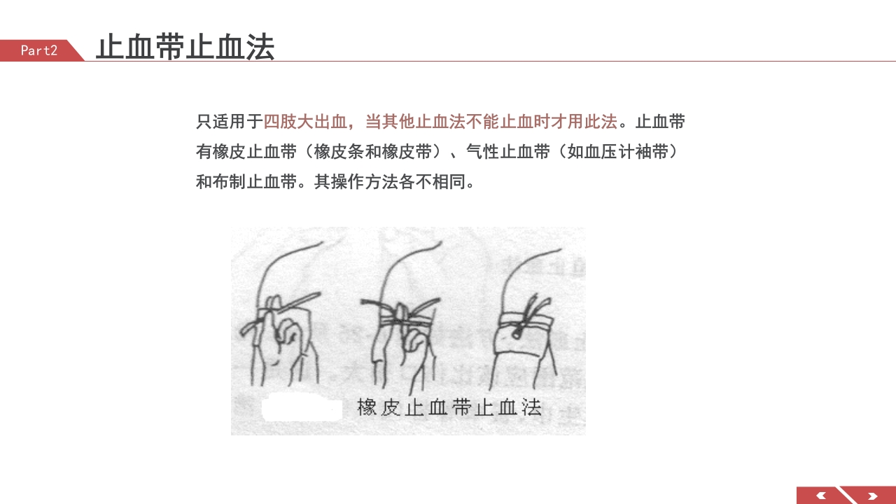 外伤急救包扎技术培训PPT课件16