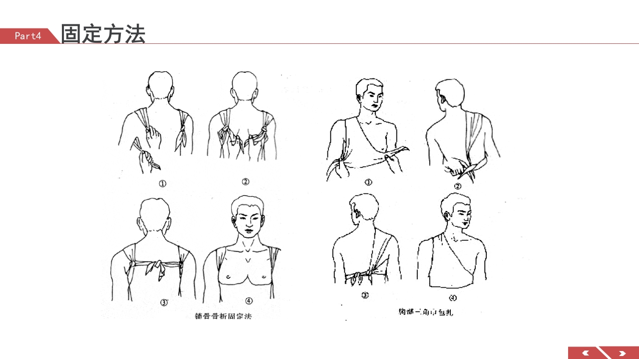 外伤急救包扎技术培训PPT课件26