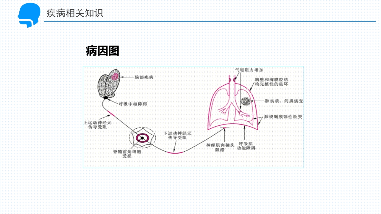 呼吸衰竭的护理查房PPT课件12