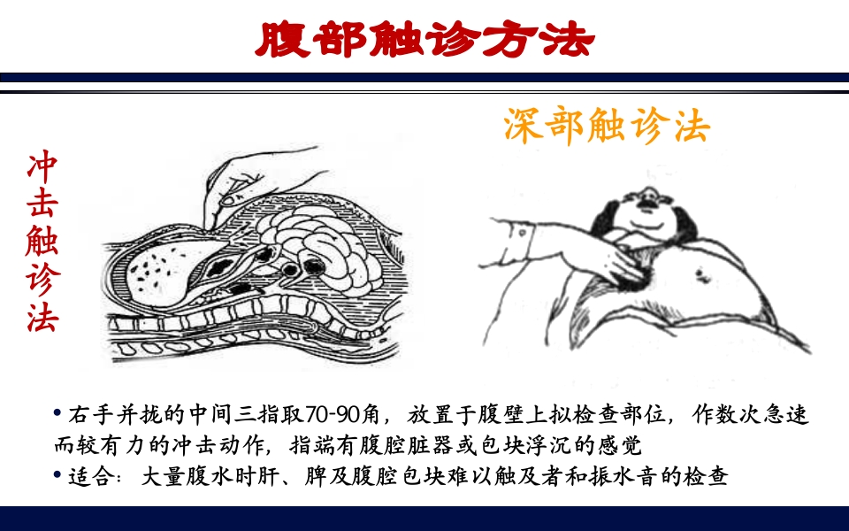 《腹部触诊》诊断学PPT课件10