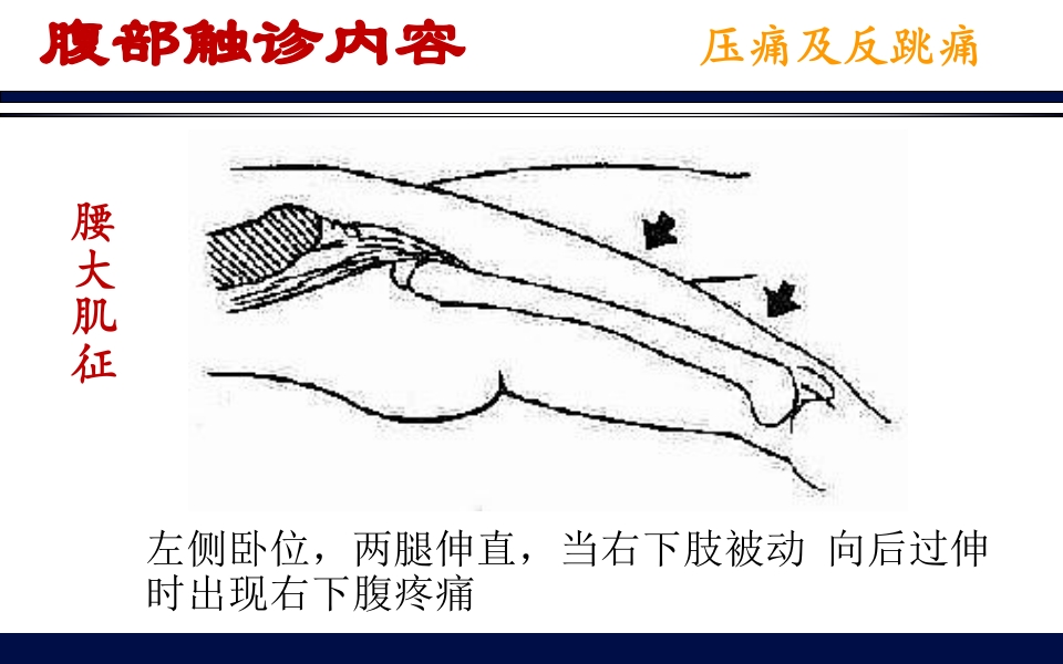 《腹部触诊》诊断学PPT课件20