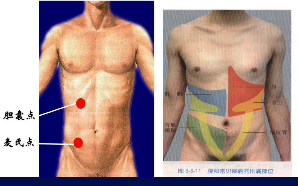 《腹部触诊》诊断学PPT课件21
