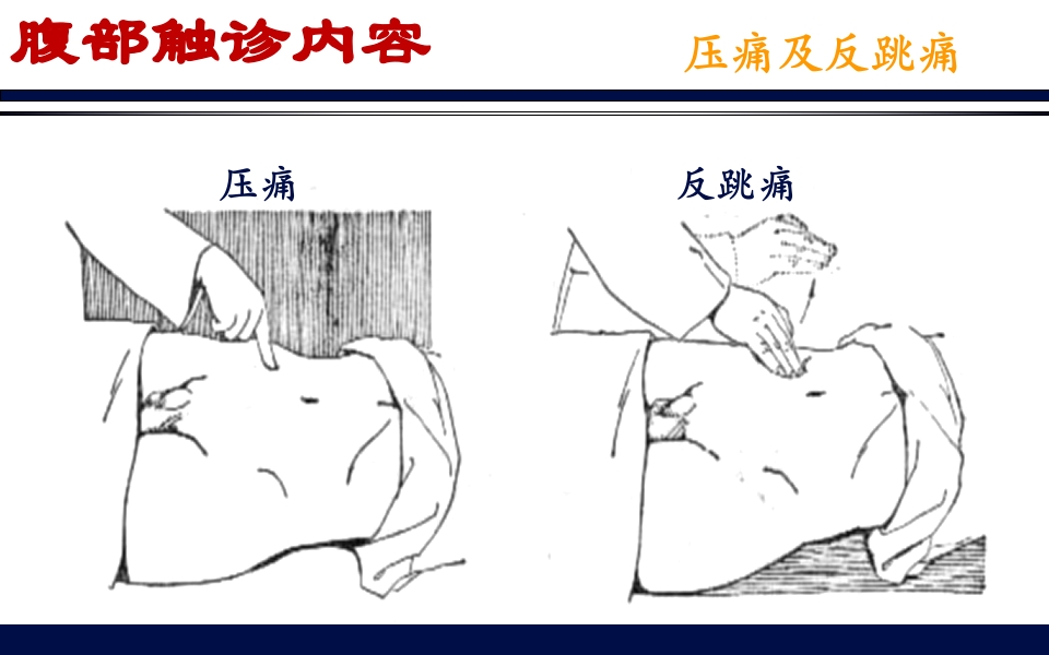 《腹部触诊》诊断学PPT课件25