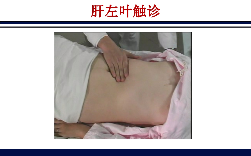 《腹部触诊》诊断学PPT课件30