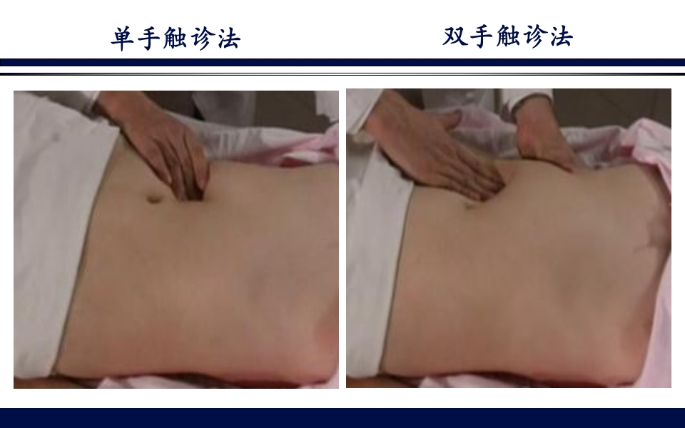 《腹部触诊》诊断学PPT课件34