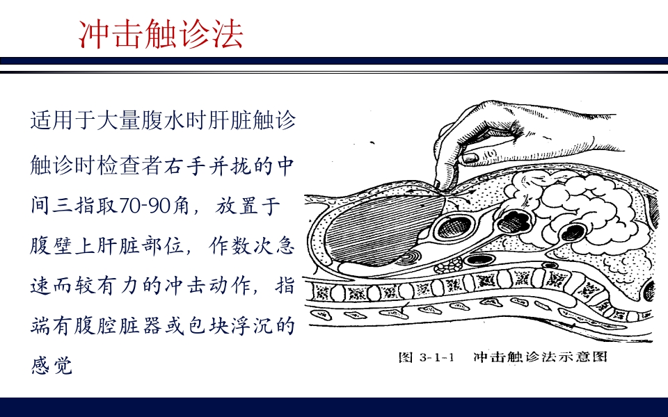《腹部触诊》诊断学PPT课件36