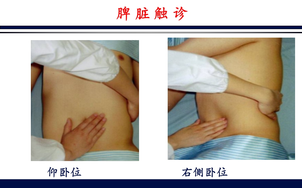 《腹部触诊》诊断学PPT课件50