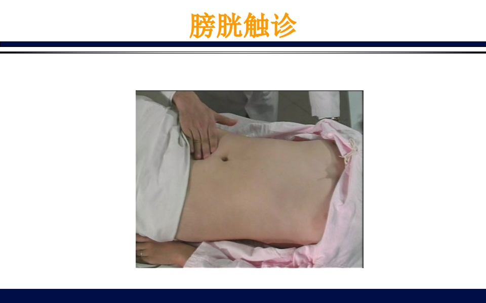 《腹部触诊》诊断学PPT课件69