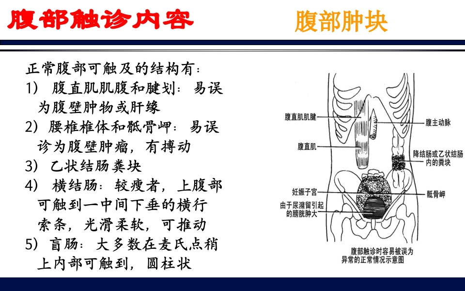 《腹部触诊》诊断学PPT课件73