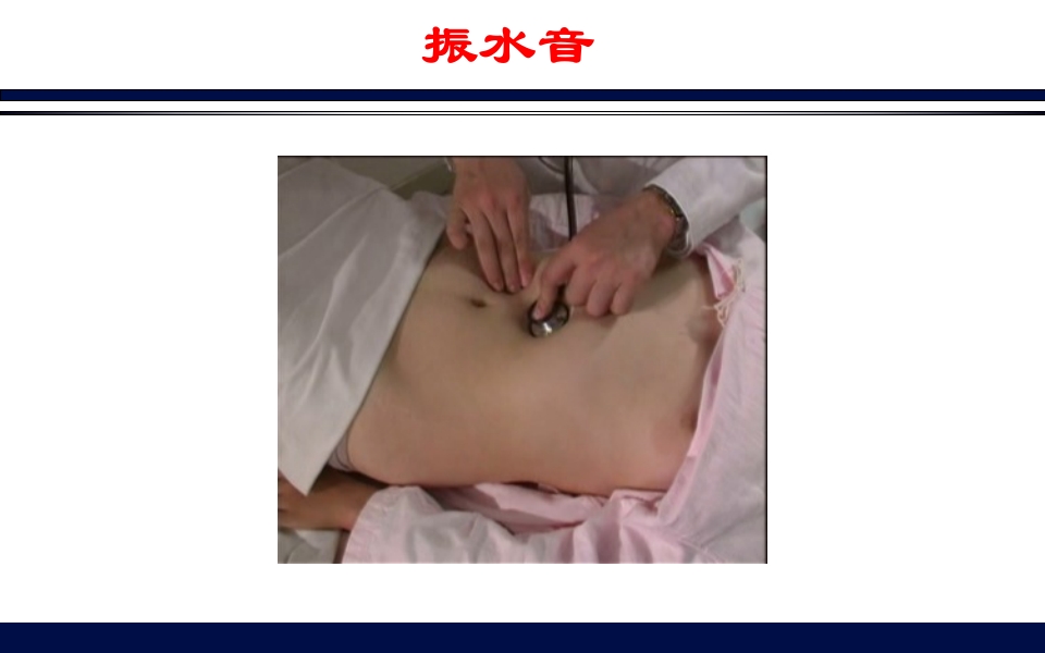 《腹部触诊》诊断学PPT课件84