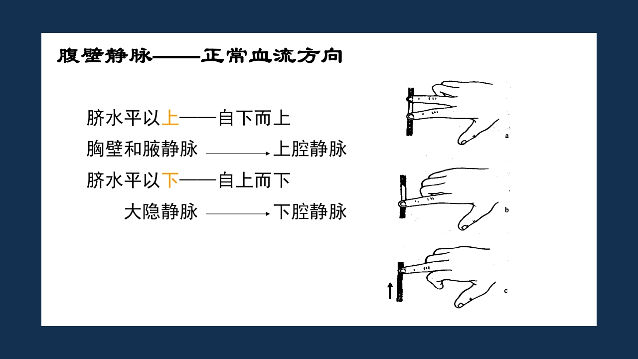 腹部体格检查及腹腔穿刺术PPT课件21
