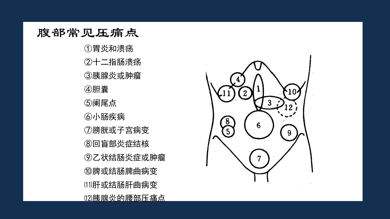 腹部体格检查及腹腔穿刺术PPT课件28