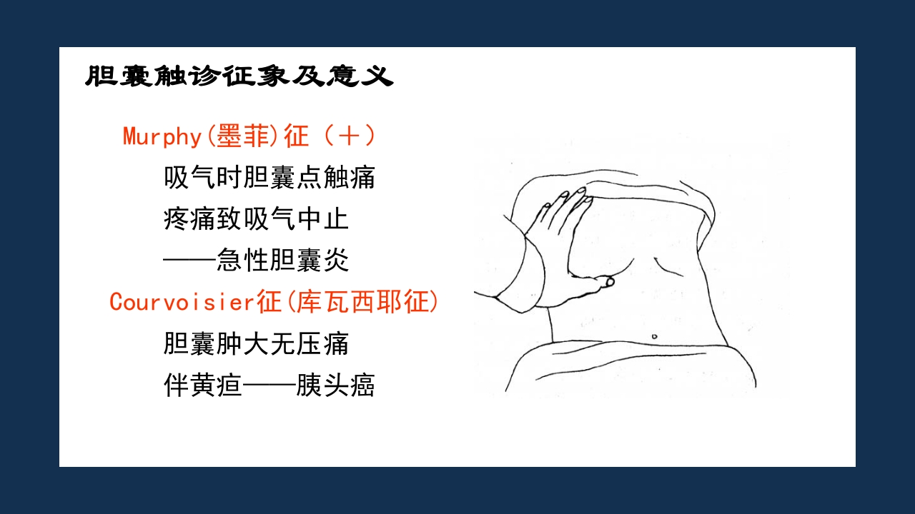 腹部体格检查及腹腔穿刺术PPT课件40