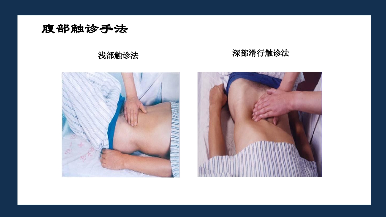 腹部体格检查及腹腔穿刺术PPT课件49