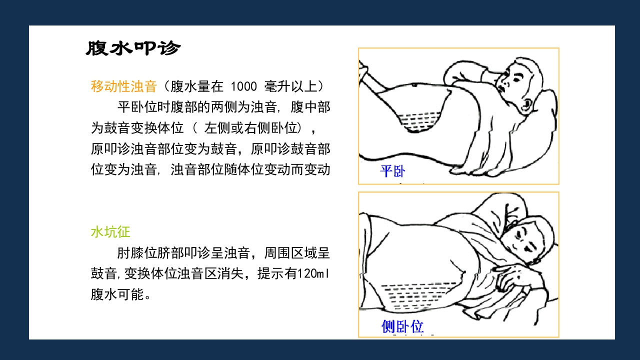 腹部体格检查及腹腔穿刺术PPT课件61