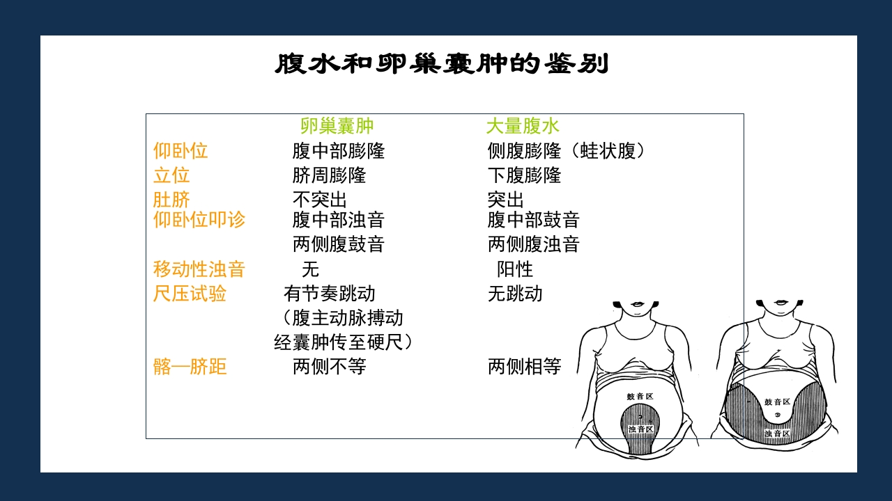 腹部体格检查及腹腔穿刺术PPT课件63