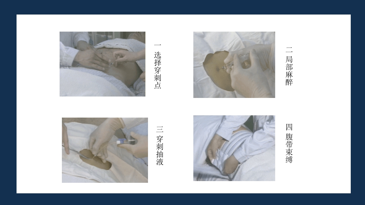 腹部体格检查及腹腔穿刺术PPT课件77