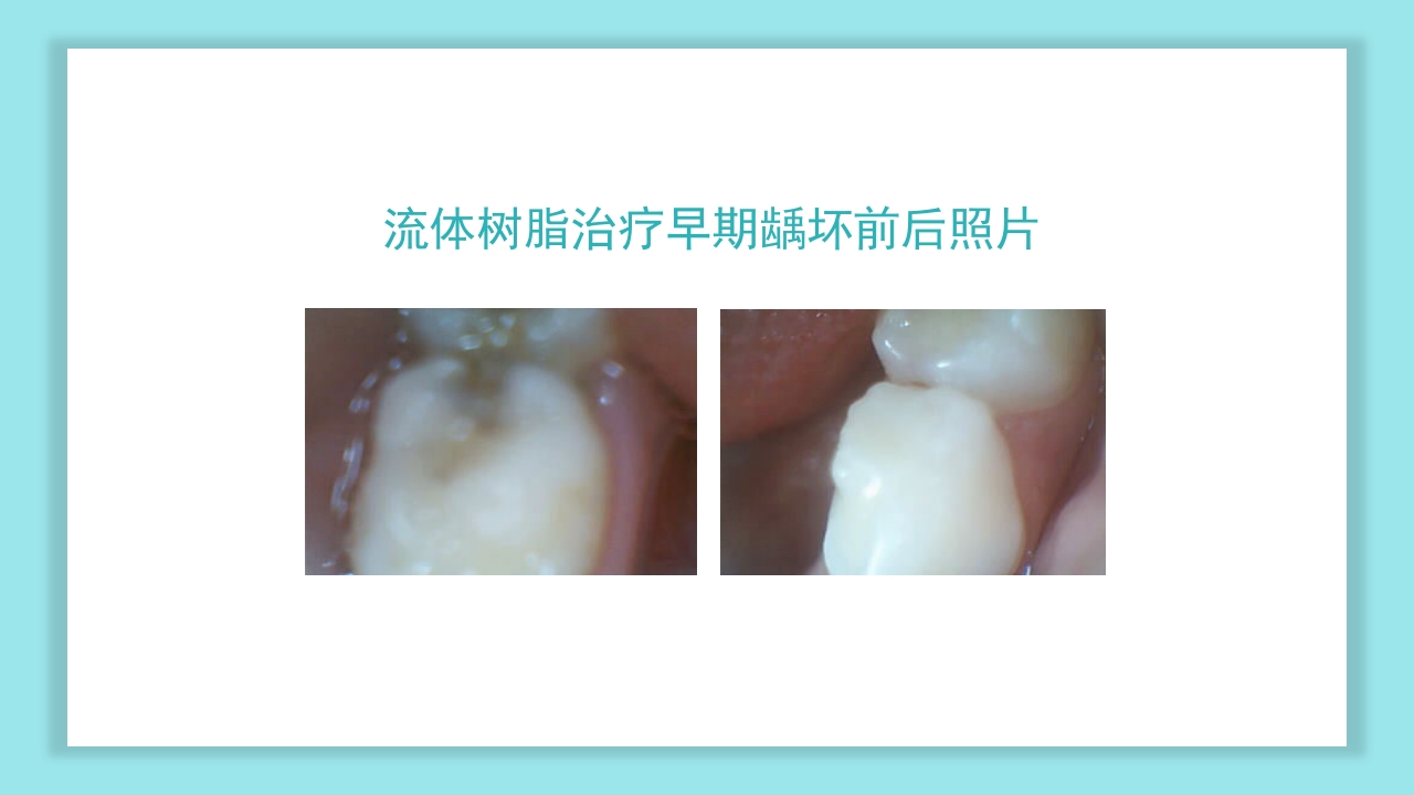 口腔健康知识讲座PPT课件16