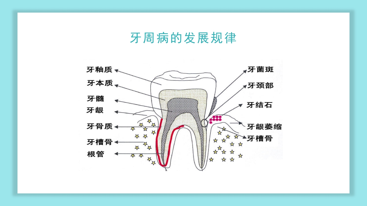 口腔健康知识讲座PPT课件19