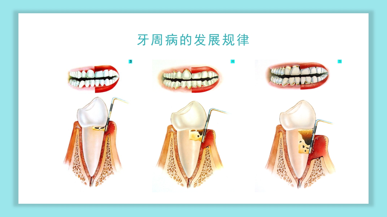 口腔健康知识讲座PPT课件21