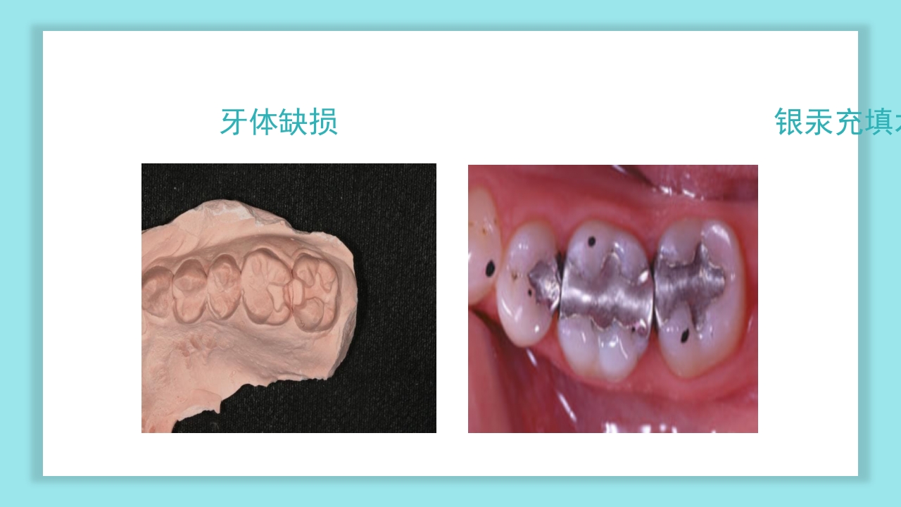 口腔健康知识讲座PPT课件29
