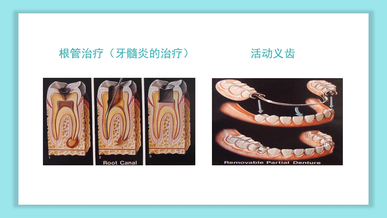 口腔健康知识讲座PPT课件33