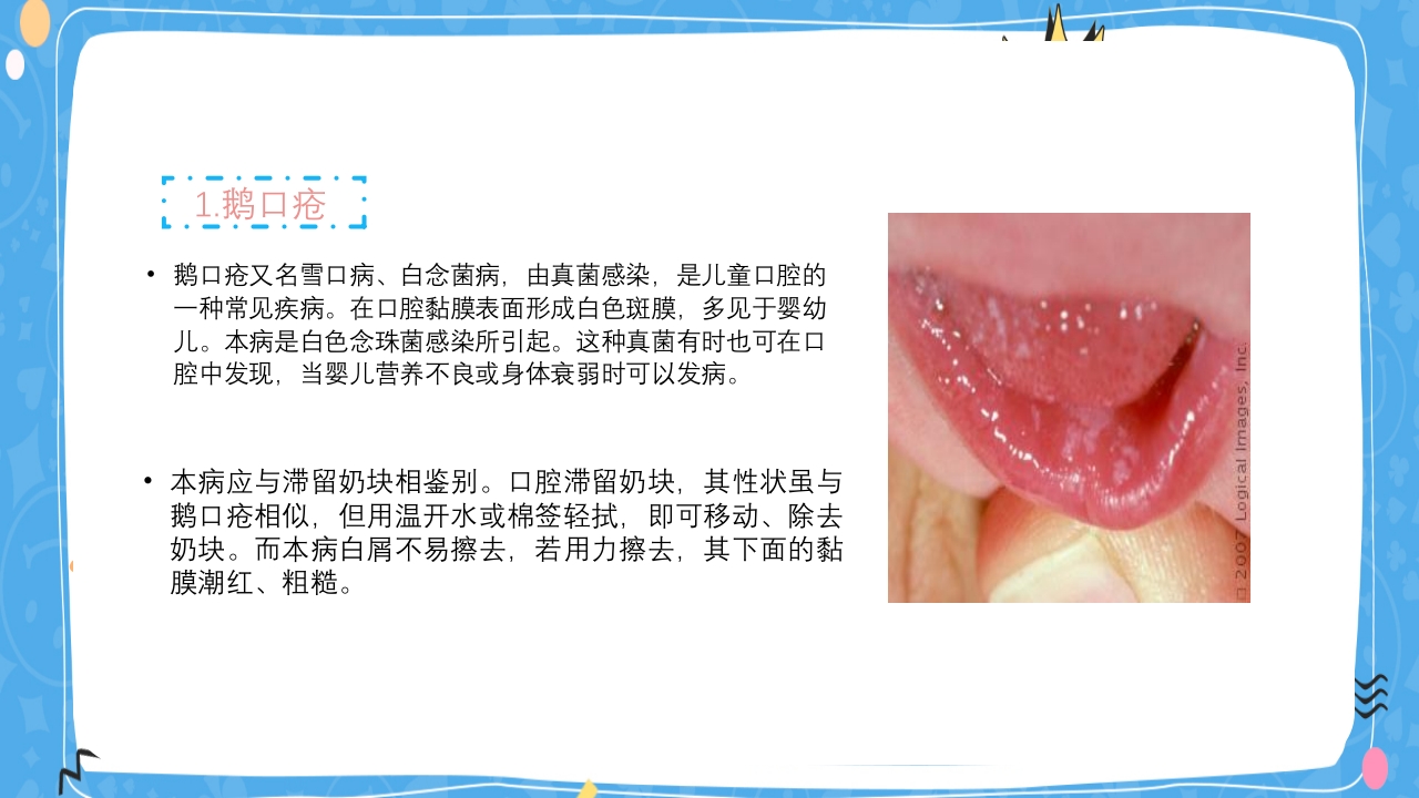 婴幼儿口腔保健知识PPT课件11