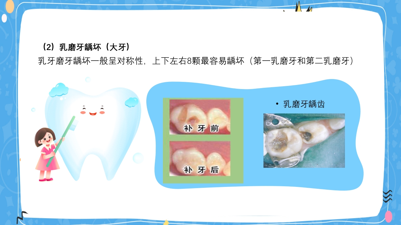 婴幼儿口腔保健知识PPT课件17