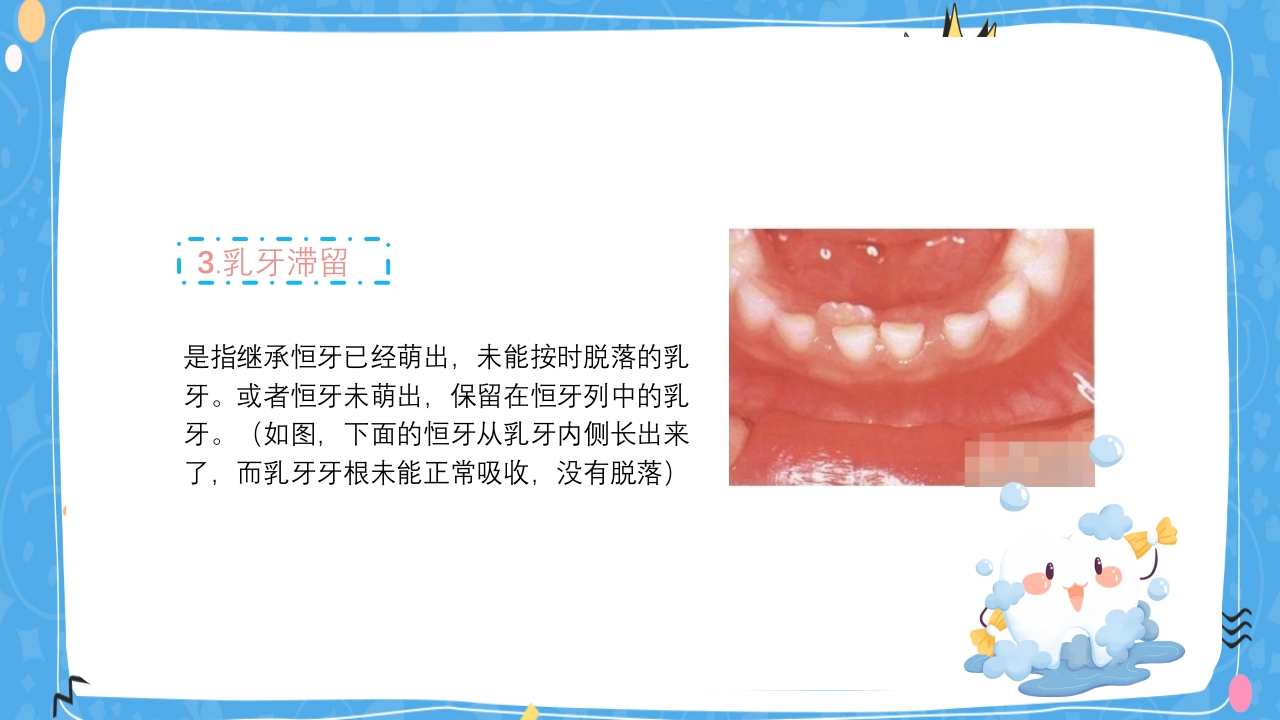 婴幼儿口腔保健知识PPT课件19